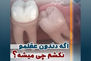 cover3